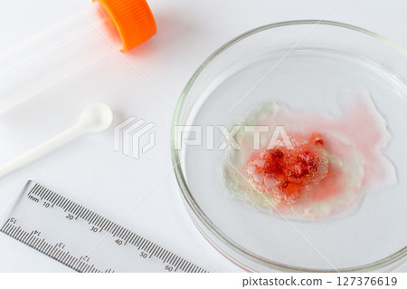 Laboratory Sample of Strawberry Alongside Essential Research Tools: An In-Depth Exploration of Food Spoilage and Safety Concerns in Microbiological Research Practices and Findings 127376619