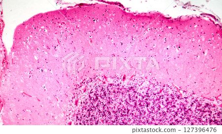 Human motor cortex, photomicrograph showing pyramidal neurons in cortical layers responsible for voluntary movement control and motor coordination. Human motor cortex, photomicrograph showing pyramidal neurons in cortical layers responsible for voluntary movement control and motor coordination. 127396476