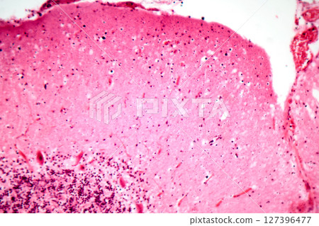 Human motor cortex, photomicrograph showing pyramidal neurons in cortical layers responsible for voluntary movement control and motor coordination. 127396477