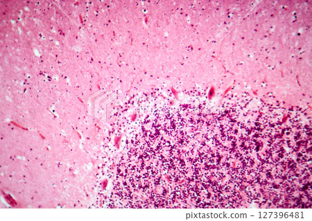 Human motor cortex, photomicrograph showing pyramidal neurons in cortical layers responsible for voluntary movement control and motor coordination. 127396481