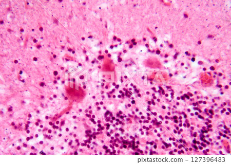 Human motor cortex, photomicrograph showing pyramidal neurons in cortical layers responsible for voluntary movement control and motor coordination. Human motor cortex, photomicrograph showing pyramidal neurons in cortical layers responsible for voluntary movement control and motor coordination. 127396483