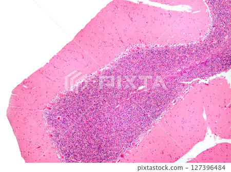 Human cerebellar cortex, photomicrograph showing Purkinje cells, granular cells, and molecular layer involved in motor coordination and balance. 127396484
