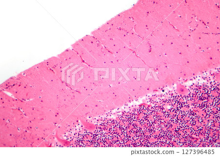Human cerebellar cortex, photomicrograph showing Purkinje cells, granular cells, and molecular layer involved in motor coordination and balance. 127396485