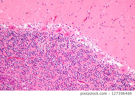 Human cerebellar cortex, photomicrograph showing Purkinje cells, granular cells, and molecular layer involved in motor coordination and balance. 127396486
