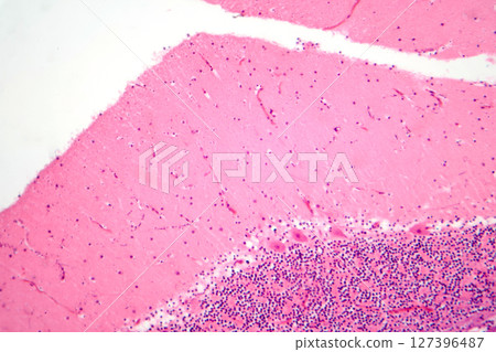 Human cerebellar cortex, photomicrograph showing Purkinje cells, granular cells, and molecular layer involved in motor coordination and balance. 127396487