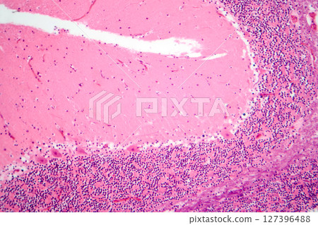 Human cerebellar cortex, photomicrograph showing Purkinje cells, granular cells, and molecular layer involved in motor coordination and balance. 127396488