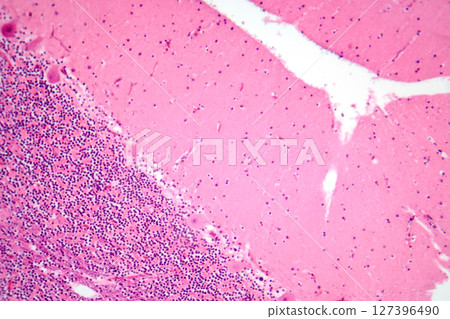 Human cerebellar cortex, photomicrograph showing Purkinje cells, granular cells, and molecular layer involved in motor coordination and balance. 127396490