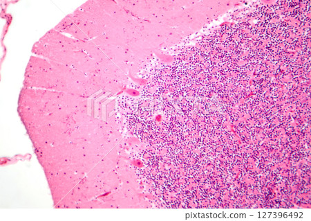 Human cerebellar cortex, photomicrograph showing Purkinje cells, granular cells, and molecular layer involved in motor coordination and balance. 127396492