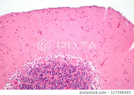 Human cerebellar cortex, photomicrograph showing Purkinje cells, granular cells, and molecular layer involved in motor coordination and balance. Human cerebellar cortex, photomicrograph showing Purkinje cells, granular cells, and molecular layer involved in motor coordination and balance. 127396493