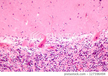 Human cerebellar cortex, photomicrograph showing Purkinje cells, granular cells, and molecular layer involved in motor coordination and balance. 127396494