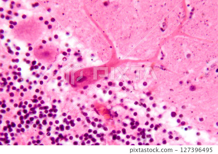 Human cerebellar cortex, photomicrograph showing Purkinje cells, granular cells, and molecular layer involved in motor coordination and balance. 127396495