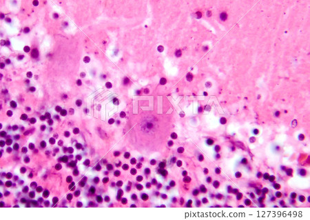 Human cerebellar cortex, photomicrograph showing Purkinje cells, granular cells, and molecular layer involved in motor coordination and balance. 127396498