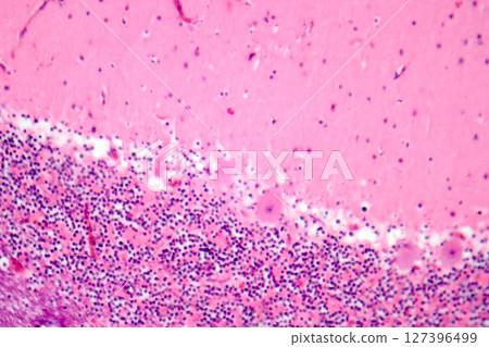 Human cerebellar cortex, photomicrograph showing Purkinje cells, granular cells, and molecular layer involved in motor coordination and balance. Human cerebellar cortex, photomicrograph showing Purkinje cells, granular cells, and molecular layer involved in motor coordination and balance. 127396499