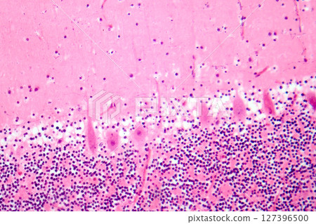 Human cerebellar cortex, photomicrograph showing Purkinje cells, granular cells, and molecular layer involved in motor coordination and balance. 127396500