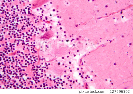 Human cerebellar cortex, photomicrograph showing Purkinje cells, granular cells, and molecular layer involved in motor coordination and balance. Human cerebellar cortex, photomicrograph showing Purkinje cells, granular cells, and molecular layer involved in motor coordination and balance. 127396502