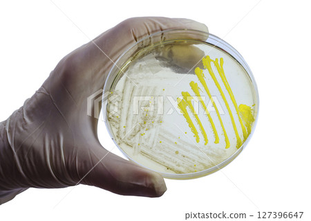Colonies of different bacteria and mold fungi grown on Petri dish with nutrient agar Colonies of different bacteria and mold fungi grown on Petri dish with nutrient agar 127396647