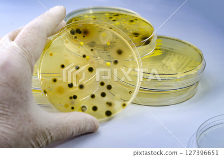 Colonies of different bacteria and mold fungi grown on Petri dish with nutrient agar 127396651