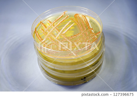 Colonies of different bacteria and molds 127396675