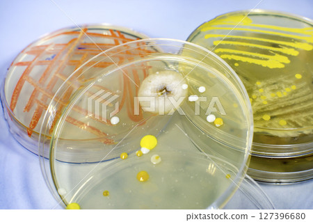 Colonies of different bacteria and molds Colonies of different bacteria and molds 127396680