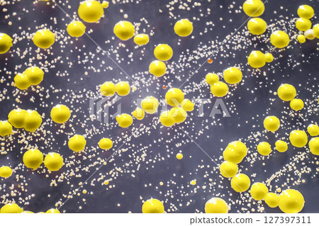 Bacteria grown from skin smear, colonies of Micrococcus luteus and Staphylococcus epidermidis Bacteria grown from skin smear, colonies of Micrococcus luteus and Staphylococcus epidermidis 127397311