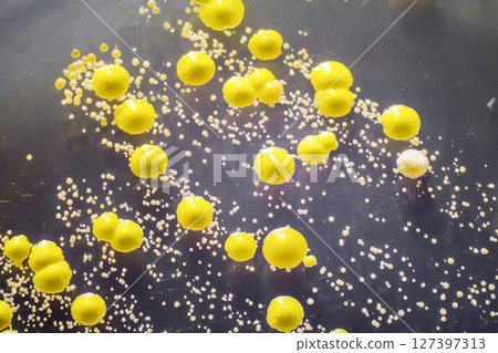 Bacteria grown from skin smear, colonies of Micrococcus luteus and Staphylococcus epidermidis Bacteria grown from skin smear, colonies of Micrococcus luteus and Staphylococcus epidermidis 127397313
