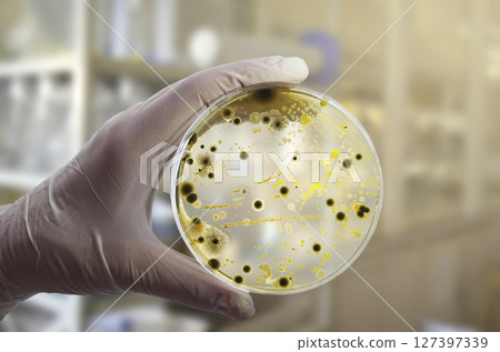 Colonies of different bacteria and mold fungi grown on Petri dish with nutrient agar Colonies of different bacteria and mold fungi grown on Petri dish with nutrient agar 127397339