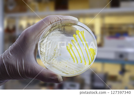 Colonies of different bacteria and mold fungi grown on Petri dish with nutrient agar Colonies of different bacteria and mold fungi grown on Petri dish with nutrient agar 127397340