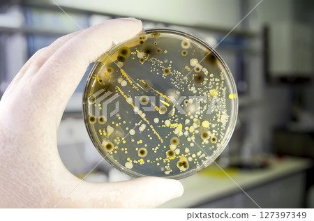 Colonies of different bacteria and mold fungi grown on Petri dish with nutrient agar Colonies of different bacteria and mold fungi grown on Petri dish with nutrient agar 127397349