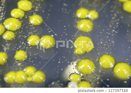 Bacteria grown from skin smear 127397388