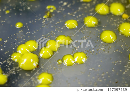 Bacteria grown from skin smear 127397389