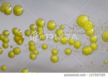 Bacteria grown from skin smear 127397395