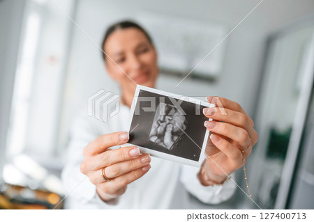 Standing and smiling. Woman in white coat is holding ultrasound picture of baby photo 127400713