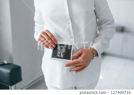 Woman in white coat is holding ultrasound picture of baby photo 127400716
