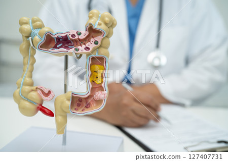 Intestine, appendix and digestive system, doctor holding anatomy model for study diagnosis and treatment in hospital. Intestine, appendix and digestive system, doctor holding anatomy model for study diagnosis and treatment in hospital. 127407731
