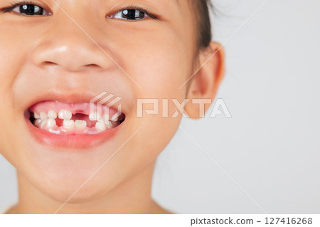 A smiling girl shows her missing tooth. The dentist discusses tooth loss and dental care, highlighting the natural process of losing baby teeth and growing new ones. close up 127416268