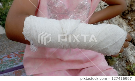 The arm of an injured child. White bandage and splint, plaster. The arm of an injured child. White bandage and splint, plaster. 127416997