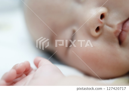 寶寶鼻子上有被自己的指甲抓傷的痕跡 127420717