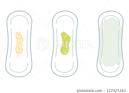 Women's health: Types of vaginal discharge, Sanitary napkins Women's health: Types of vaginal discharge, Sanitary napkins 127425162