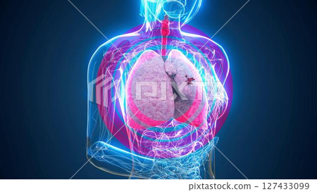 woman_lungcancer_blue woman_lungcancer_blue 127433099