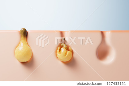 pores, inflammation, sebum 127433131