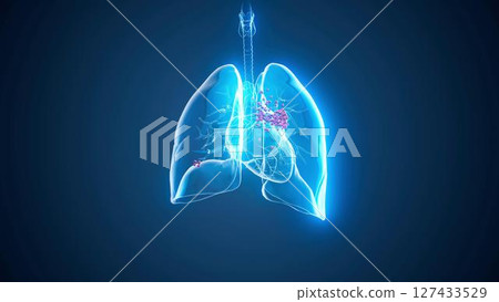 lungs_cancer_blue 127433529
