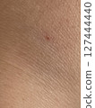 Red dots on skin close-up 127444440