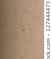Skin close-up red dots 127444473