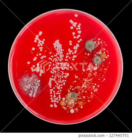 Bacterial and mold fungi colonies grown from indoor air on blood sheep agar Bacterial and mold fungi colonies grown from indoor air on blood sheep agar 127445751
