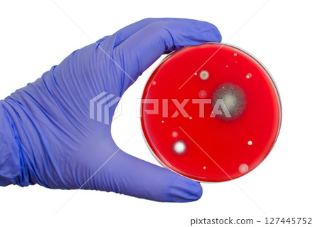 Bacterial and mold fungi colonies grown from indoor air on blood sheep agar Bacterial and mold fungi colonies grown from indoor air on blood sheep agar 127445752