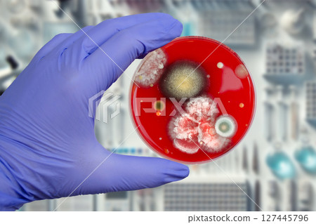 Mold fungi colonies grown from indoor air on blood sheep agar 127445796