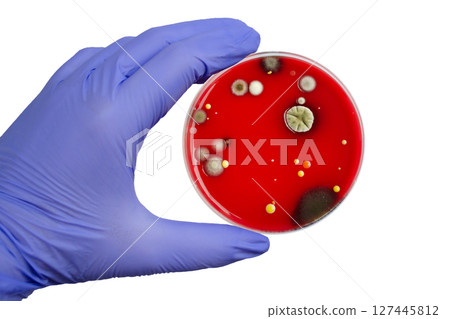 Bacterial and mold fungi colonies grown from indoor air on blood sheep agar 127445812