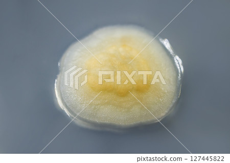 Colony of mold fungus cultivated from indoor air Colony of mold fungus cultivated from indoor air 127445822