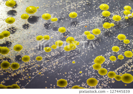 Bacteria grown from skin smear, colonies of Micrococcus luteus and Staphylococcus epidermidis Bacteria grown from skin smear, colonies of Micrococcus luteus and Staphylococcus epidermidis 127445839