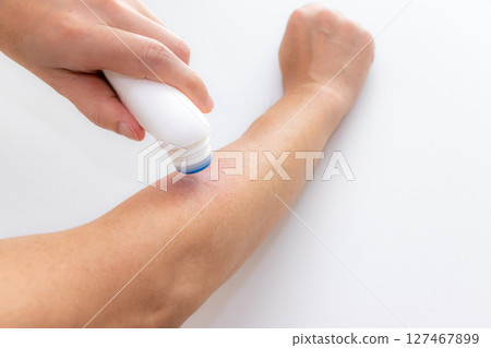在被昆蟲咬過的手臂上塗藥 127467899